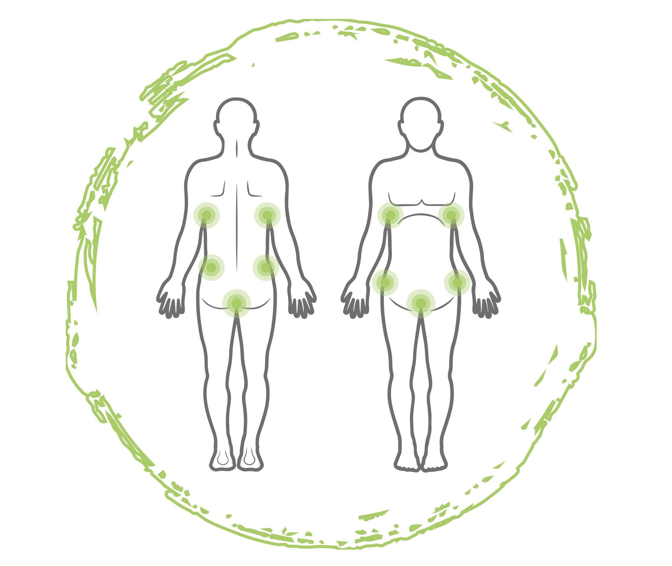 Psoriasis Formen Psoriasis Inversa Grafik 1