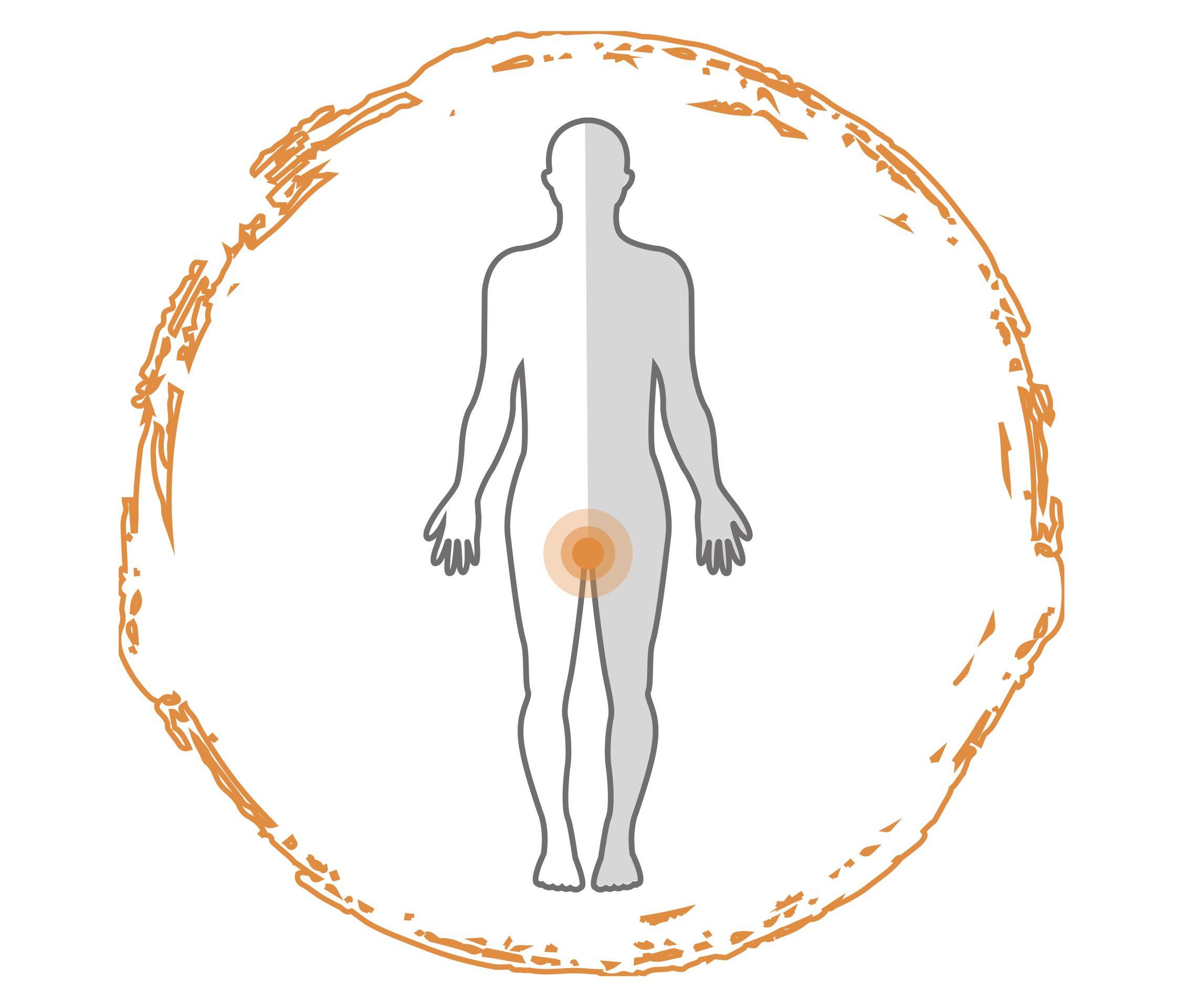 Psoriasis im Genitalbereich