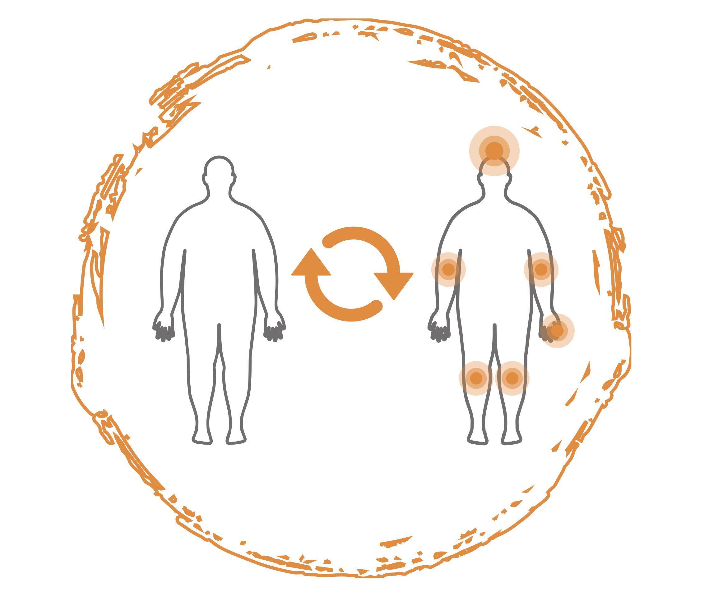 Wechselwirkung Übergewicht und Psoriasis