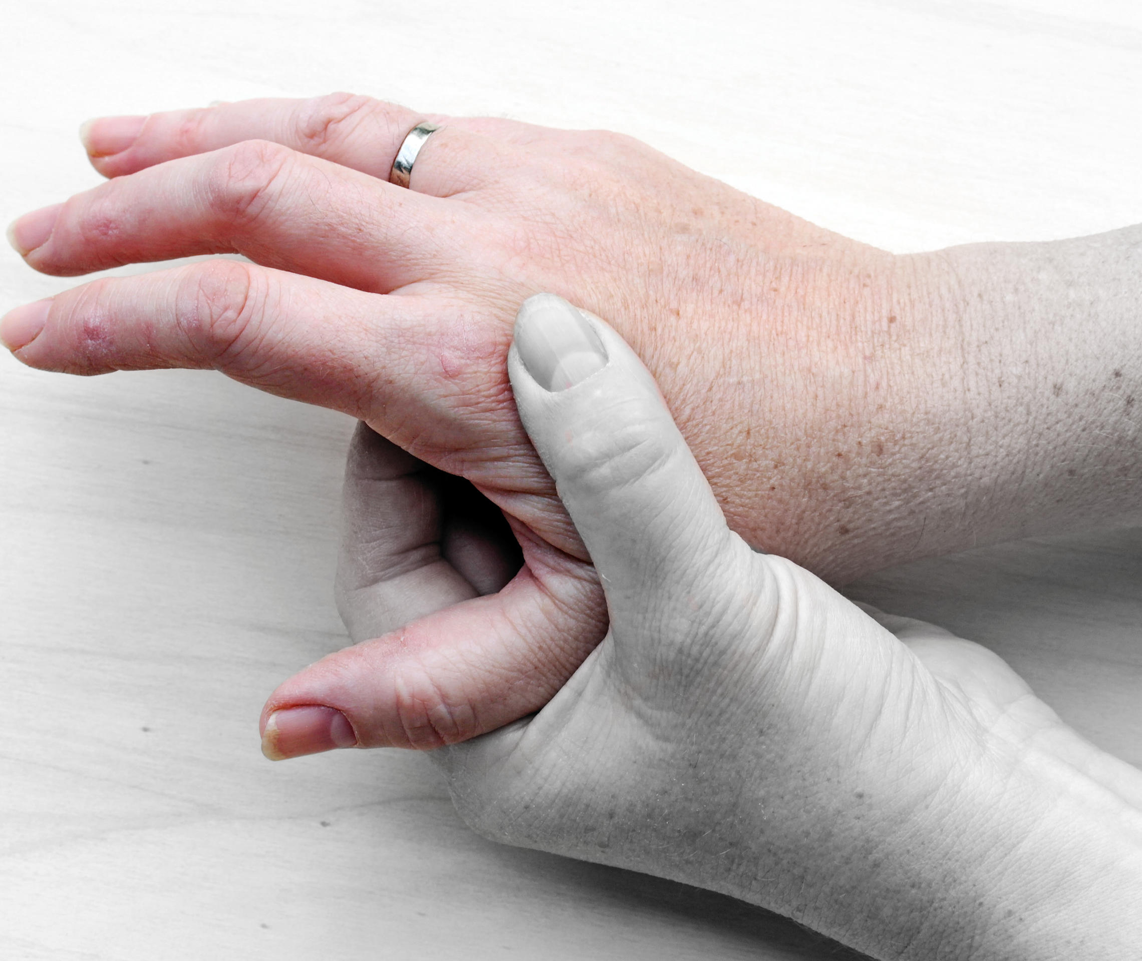 Psoriasis Arthritis