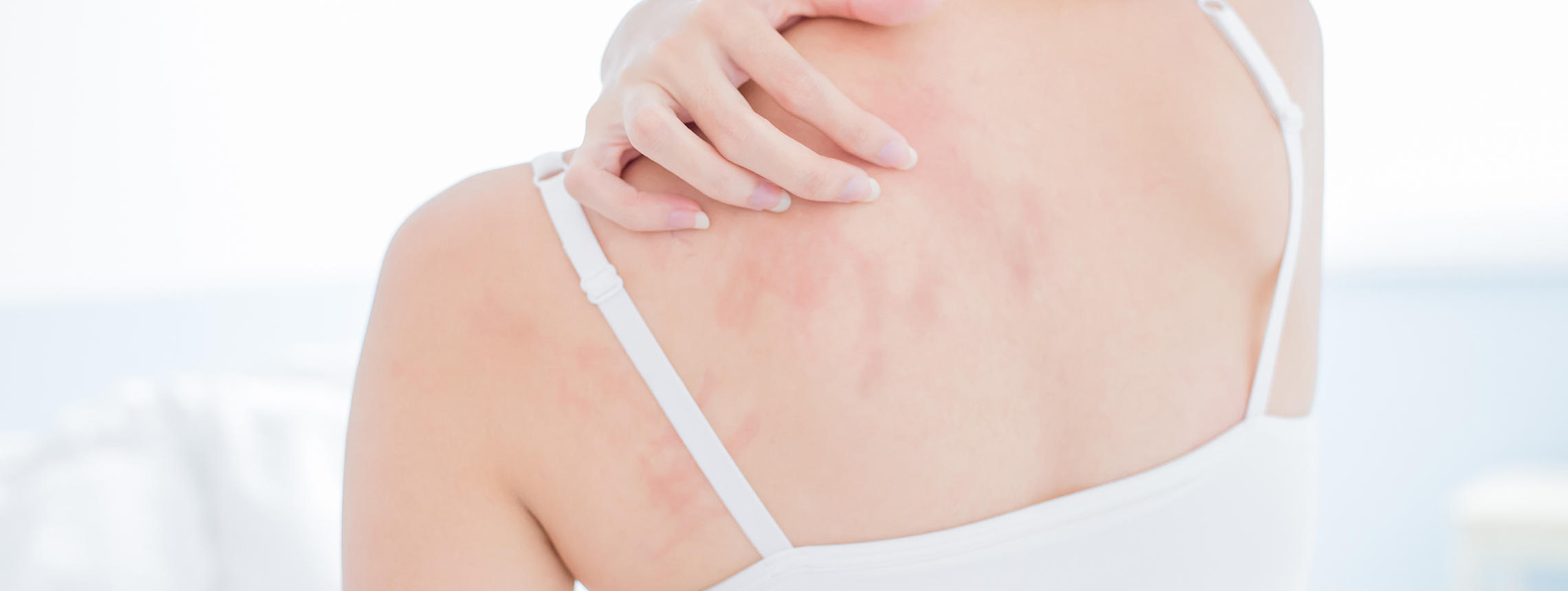 Psyche bei Psoriasis Header