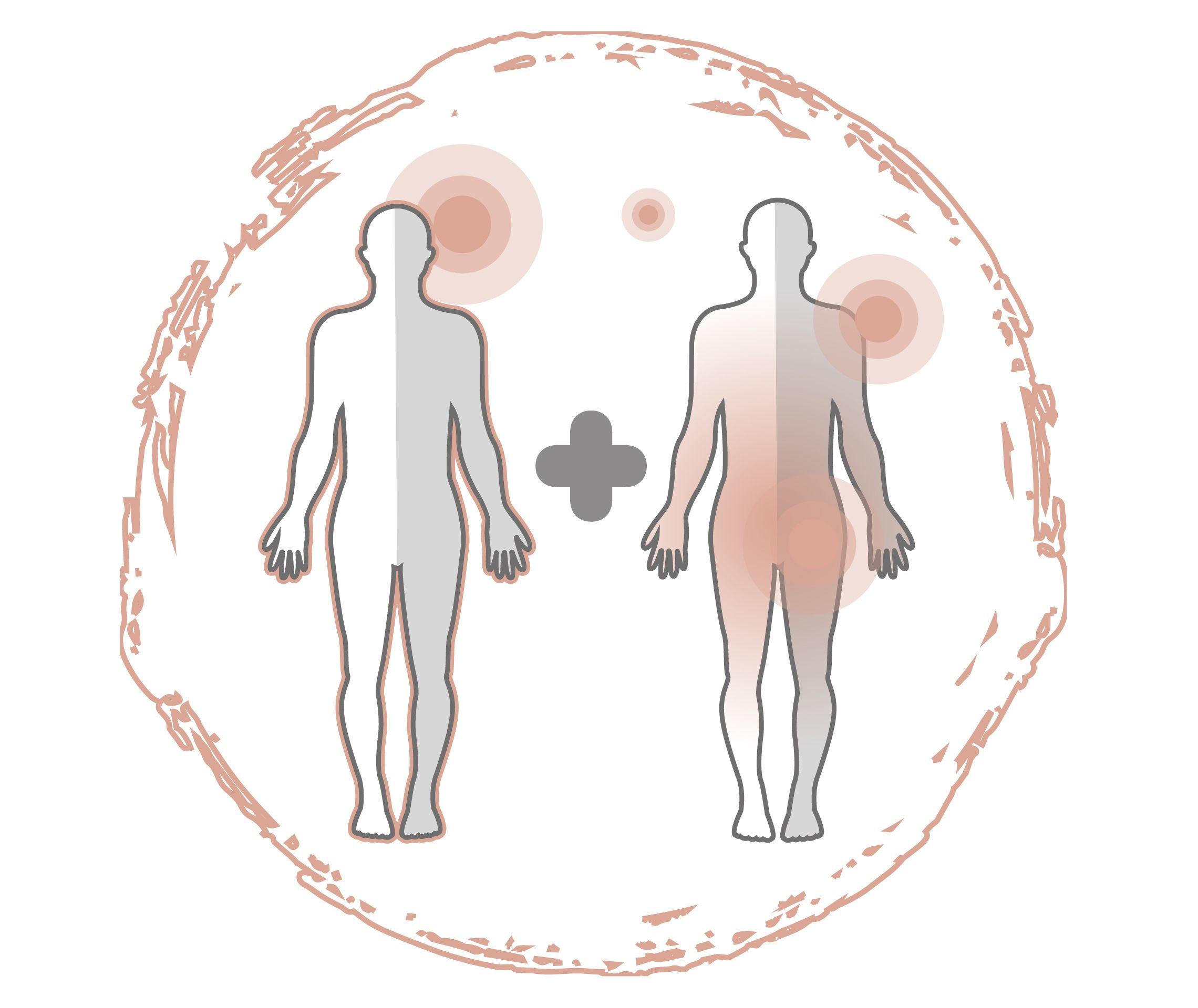 Psoriasis Behandlung Cremes unverzichtbar