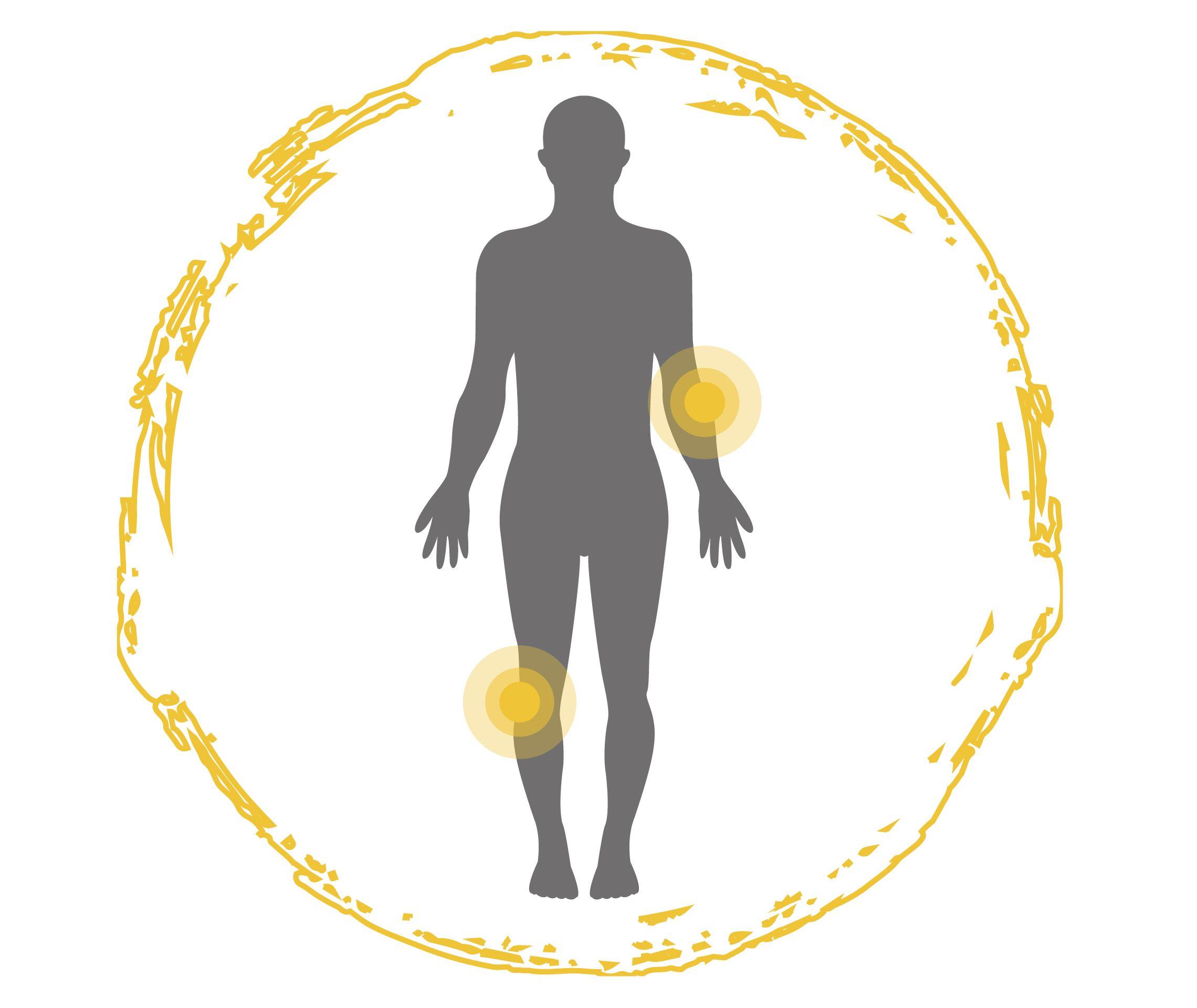 Psoriasis Info Symptome Betroffene Körperteile Grafik Ellenbogen und Knie