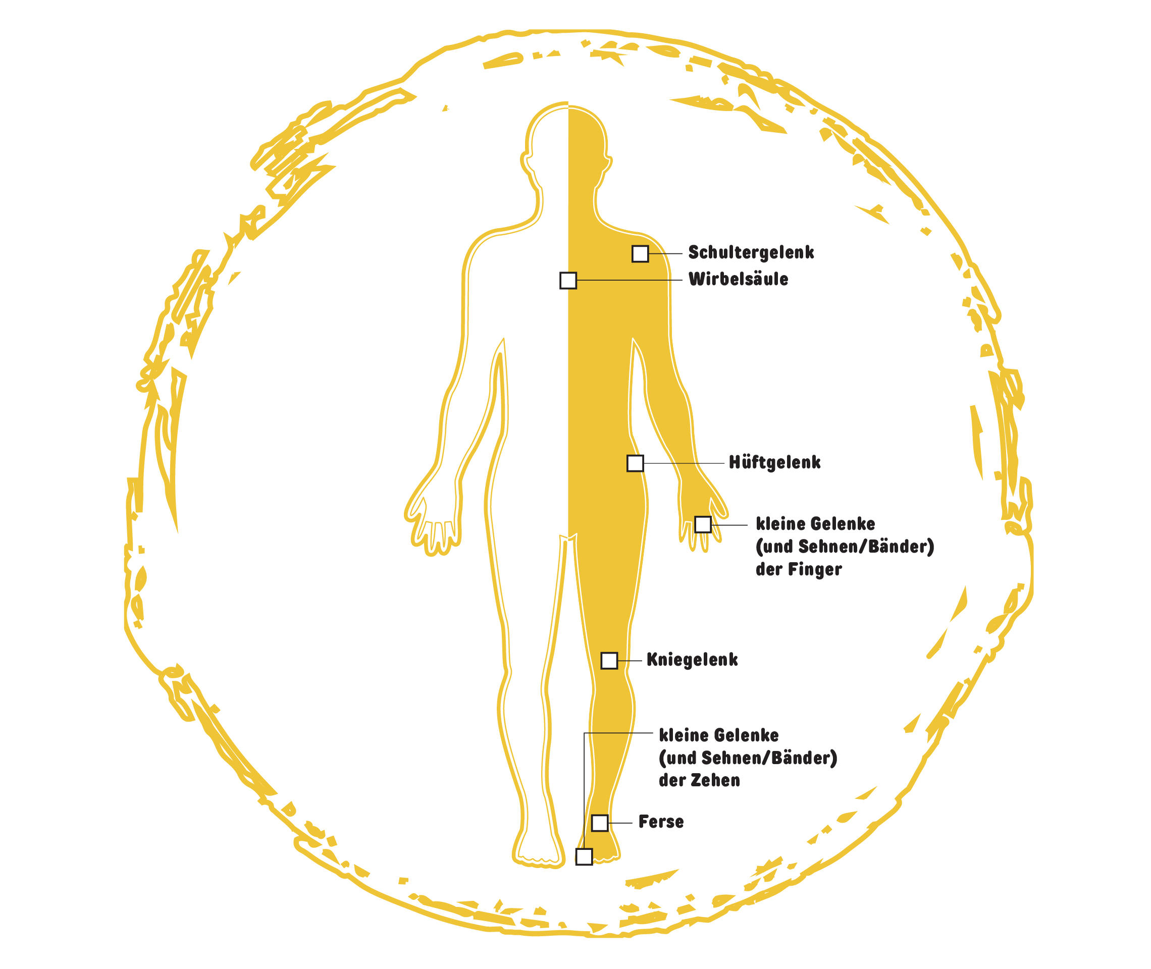 Psoriasis Info Grafik Symptome Psoriasis-Arthritis