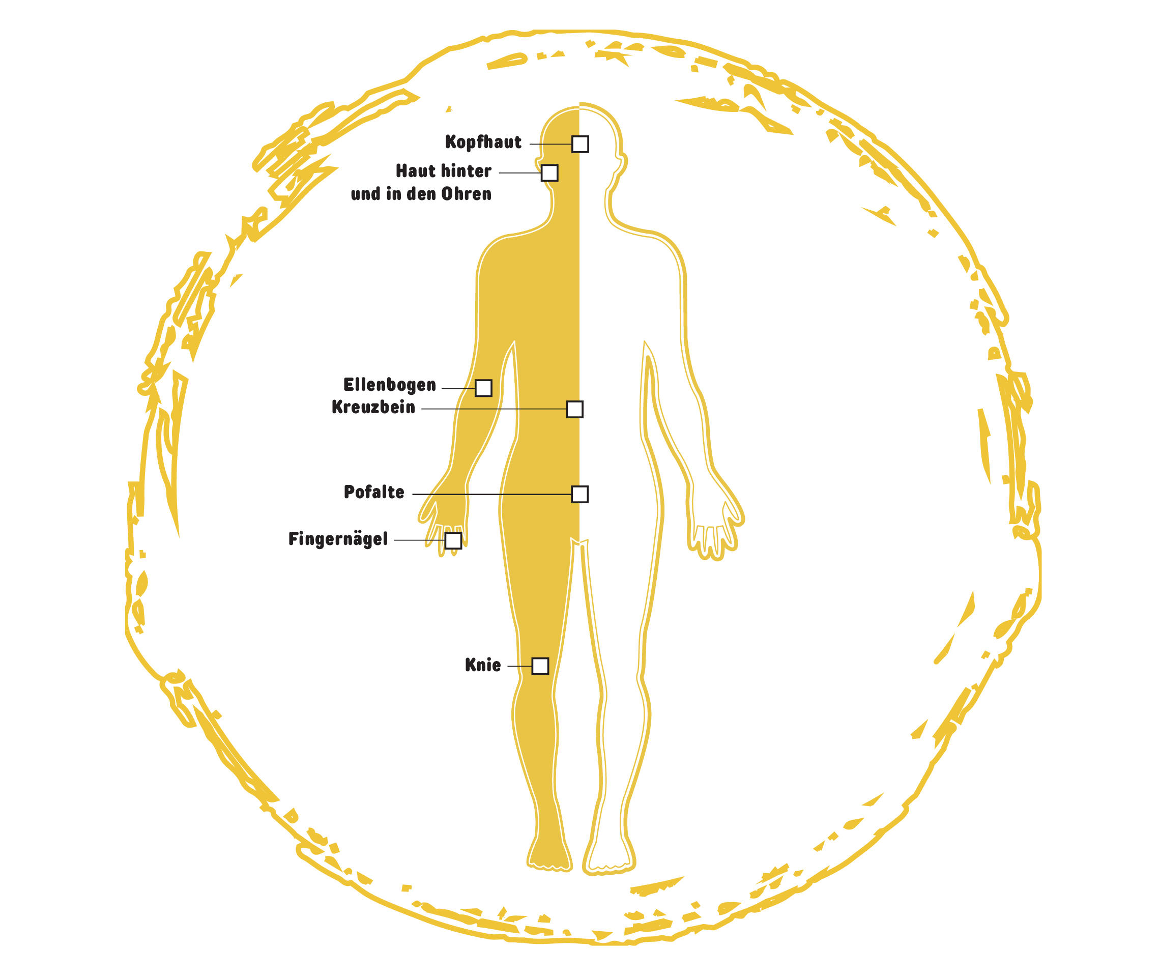 Psoriasis Info Grafik Symptome Psoriasis