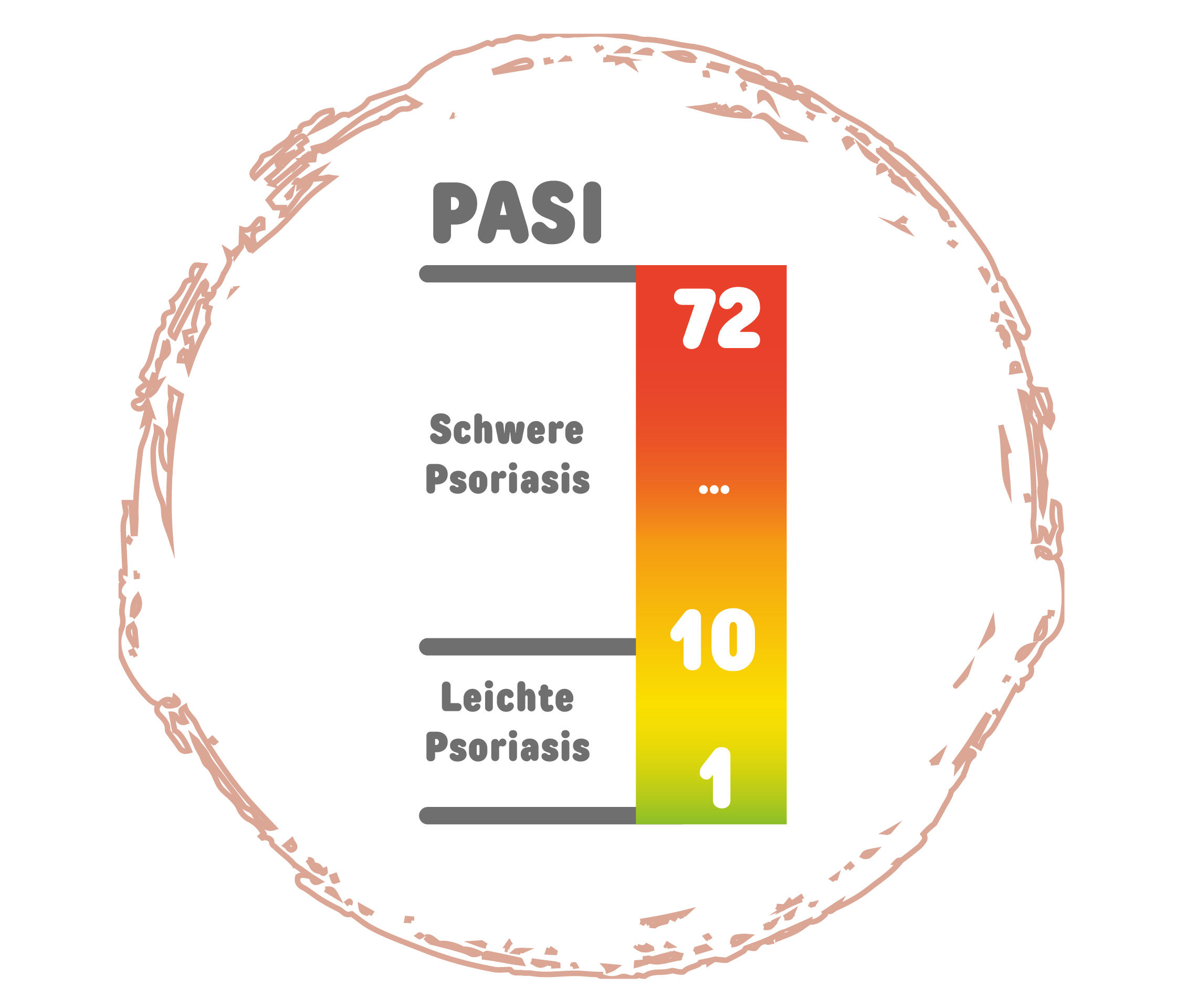 Skala zeigt Einstufung der Schweregrade nach PASI.Grafik PASI