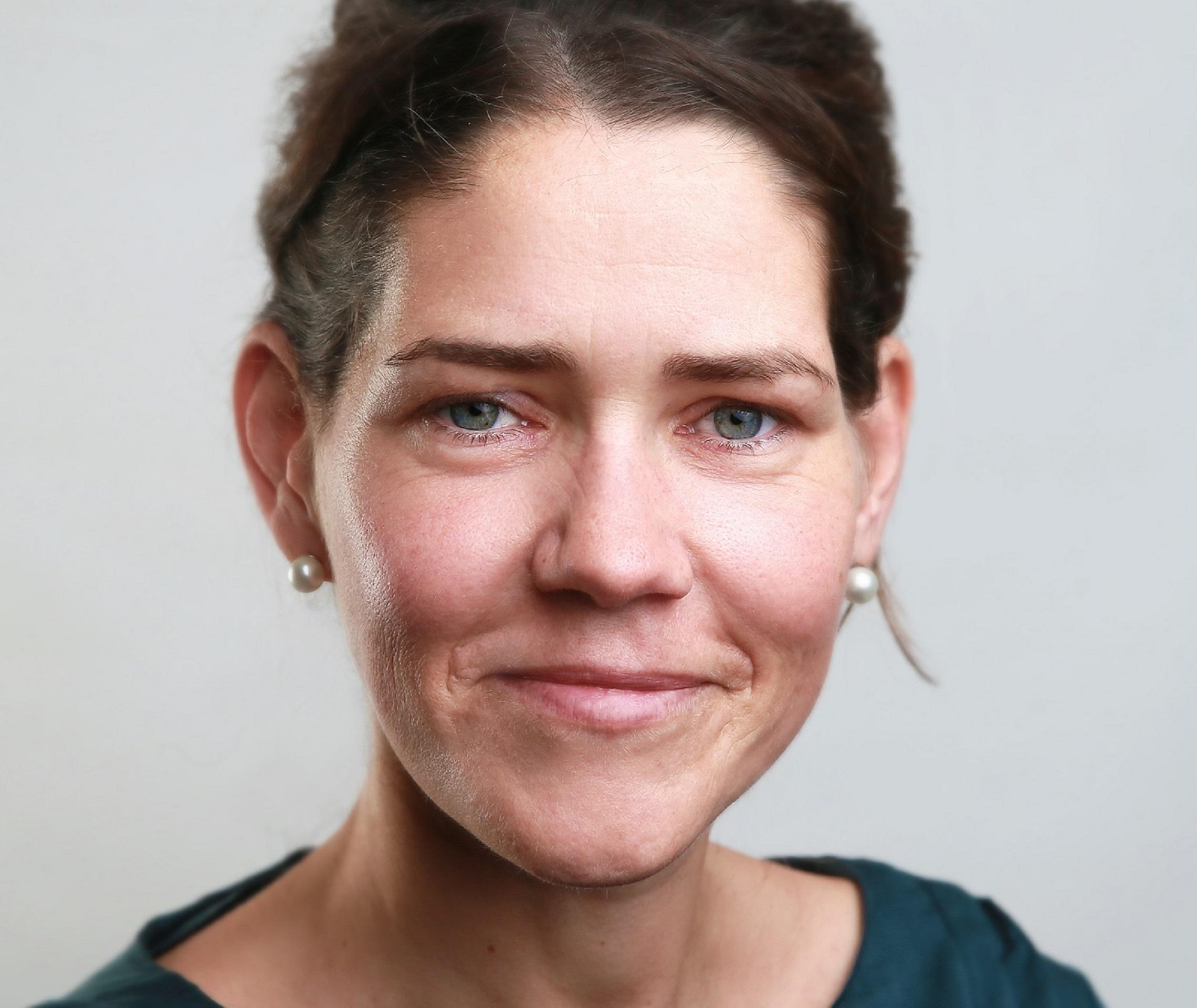 PsoriasisCamp Anne Seubert