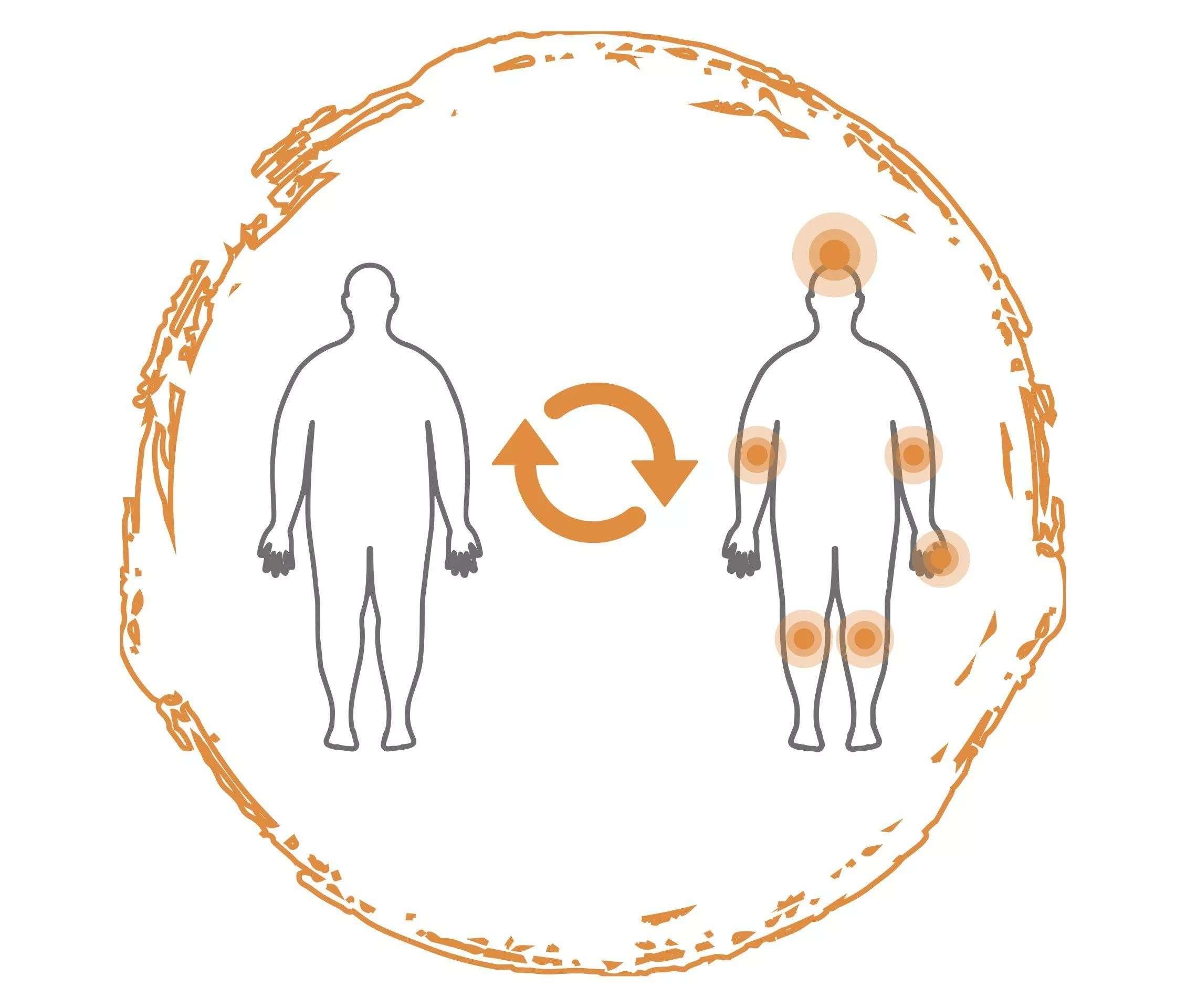 Wechselwirkung Übergewicht und Psoriasis