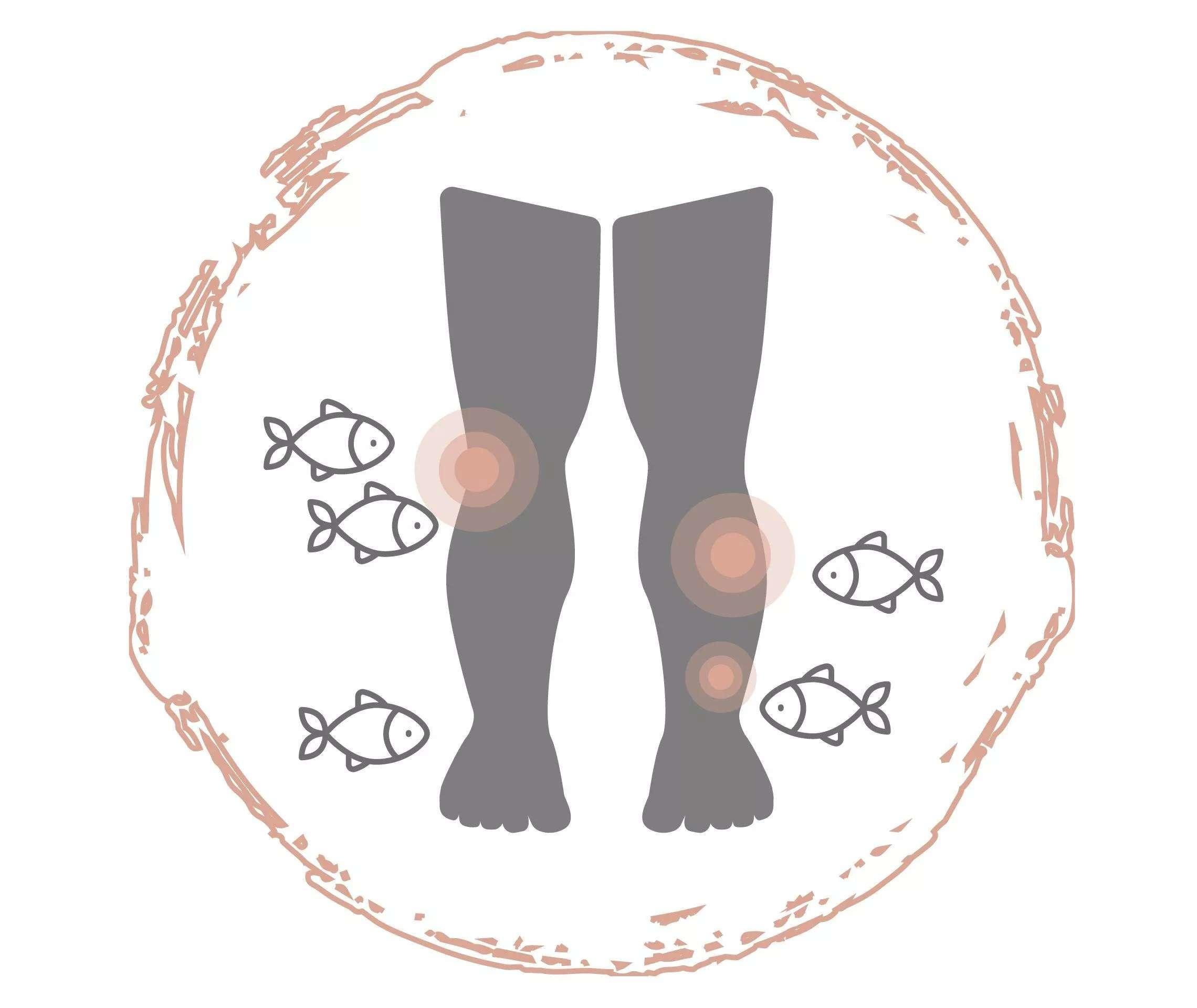 Psoriasis Homoopathie Als Alternative Psoriasis Info