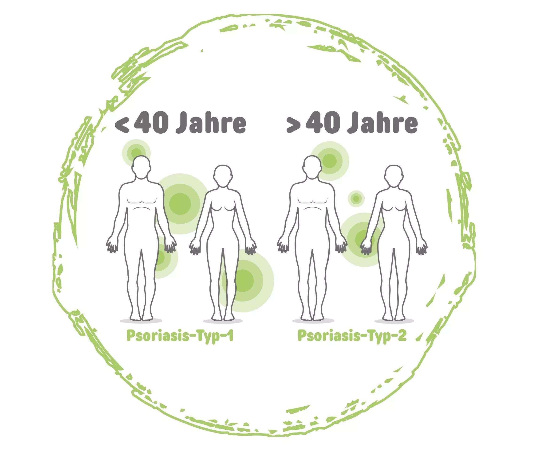 Psoriasis vulgaris: Die Einteilung in verschiedene Typen